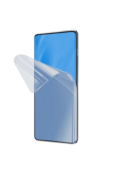 Atlas Personalized Case and Silicone Film for Samsung Galaxy A71, Moon in the Trees model, S1D1M0331