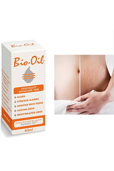 Bio-Oil بايو اويل زيت لعلاج الندوب وعلامات التمدد بالجسم 60 مل