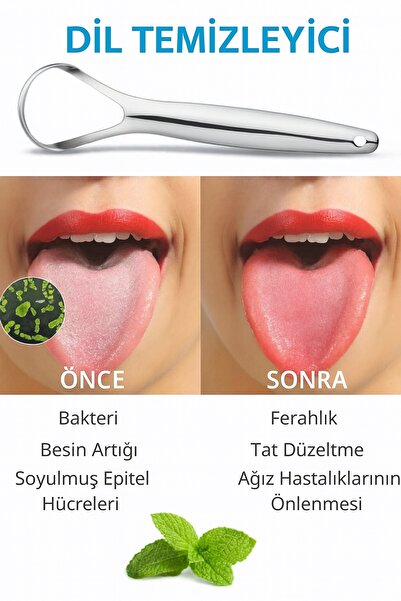 obrigado Çelik Metal Dil Temizleme Aparatı Kazıma Çubuğu Organik Diş Fırçası ...