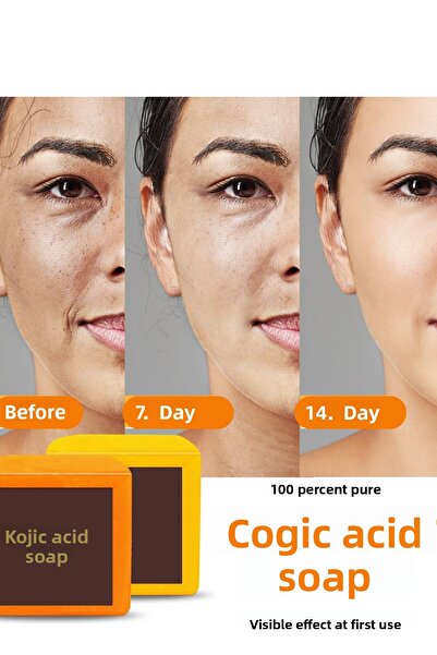 VERANT صابون حمض الكوجيك ذو نسبة عالية من الحمض (الكركم وحمض الكوجيك) صابون ح...