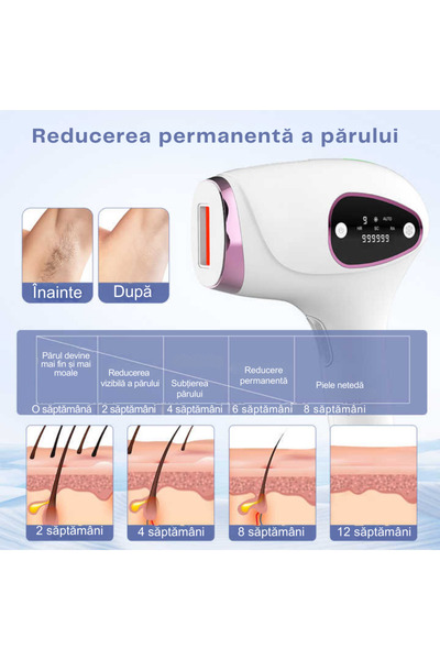 StfTauc IPL epilator, For permanent hair removal without pain, 999,999 pulses, 3 HR/SC/RA modes