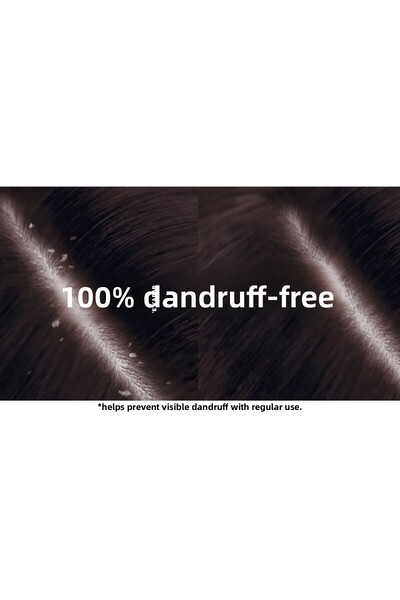 Head&Shoulders Head & Shoulders 330 Ml. Anti-Hair Loss Shampoo for Women, 72 Hours Dandruff-Free