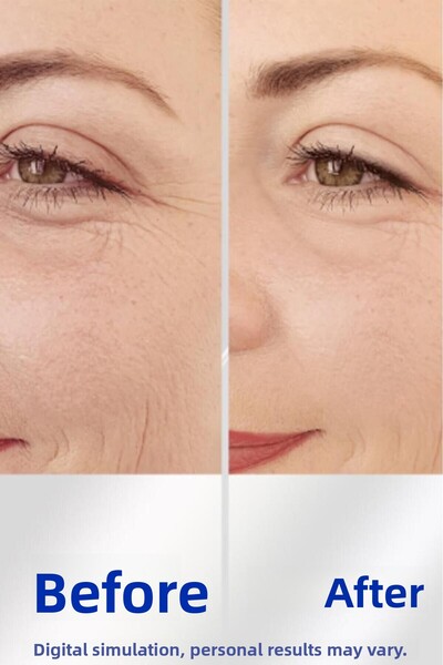 NIVEA Ser antirid cu efect instantaneu Q10 15 ml, fermitate, plinutură, hidratare