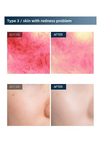 B.O.M High Coverage Foundation Spf37 and 24 Hour Protection Cover Flex Skin Fit Foundation No: 21 Rosy Beıge