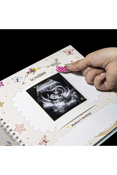 Nobbystar Baby Memory Book 0-1 Years - With Sticker Gift