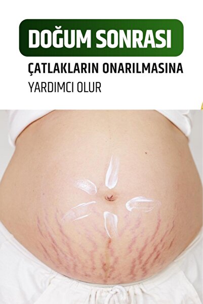 NZR BEAUTY Inceltici1 Ve Sıkılaştırıcı Vücut Şekillendirici Selülit Ve Çatlak...