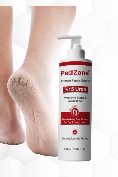 PediZone Intense Repair Foot Cream 15% Urea Cracked Heel and Foot Cream Irc, One Size