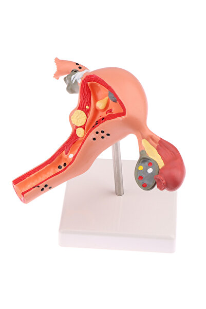 Choice 1Pcs Medical Props Model Pathological Uterus Ovary Anatomical Model Anatomy Cross Section Study Tool