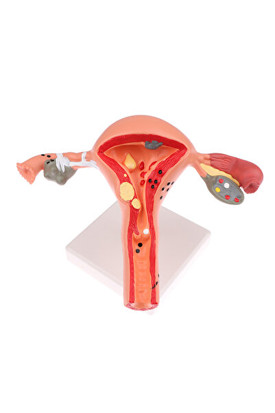 Choice 1Pcs Medical Props Model Pathological Uterus Ovary Anatomical Model Anatomy Cross Section Study Tool