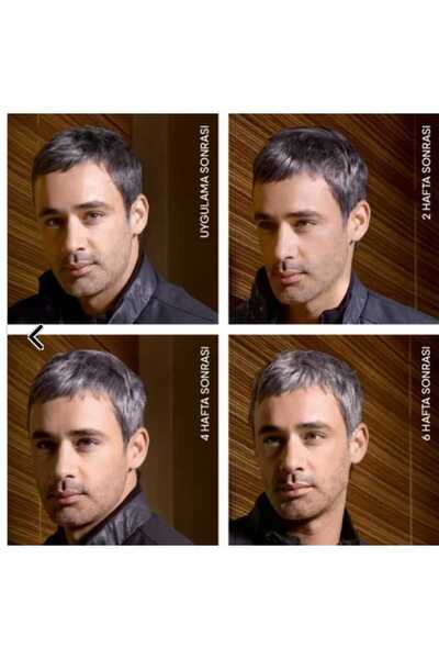 Genel Markalar 4ca Men Reshade 4*20 ml