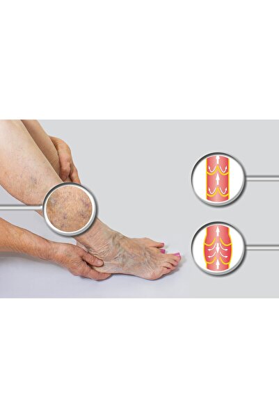 Vitaceutics Varicose Veins Gel, Venactiv, 150 ml