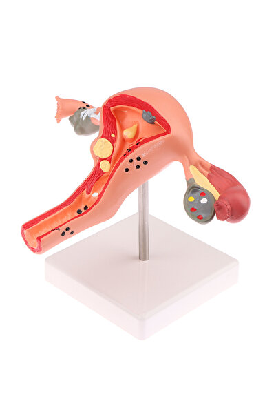 Choice 1Pcs Medical Props Model Pathological Uterus Ovary Anatomical Model Anatomy Cross Section Study Tool