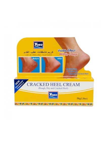YOKO كريم يوكو لتشققات الرجل 50 جرام