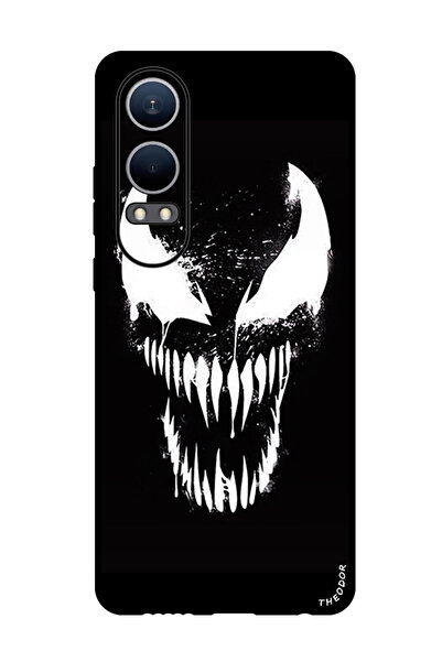 Theodor Protective Case Anti Scratch Shock Proof Bumper Cover For OnePlus Nor...