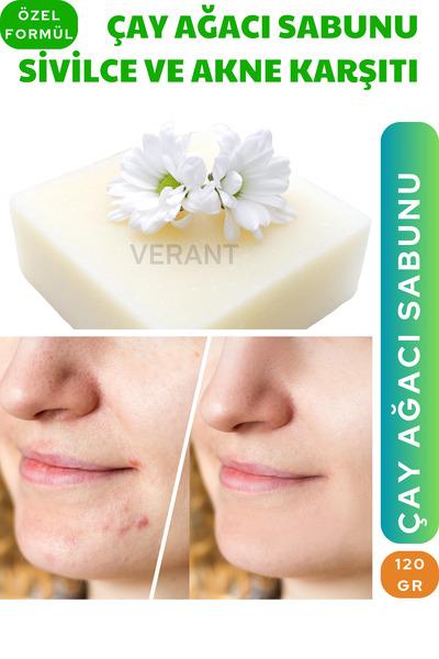 VERANT Çay Ağacı Sabunu 120 gr (SiviIce ve Akne Karşıtı)