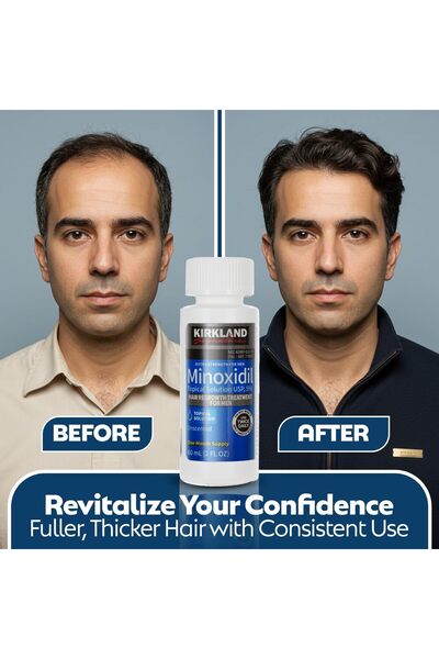 Kirkland Signature Kirkland 5 Percent Extra Strength, 2 Pack (6 Months Supply)