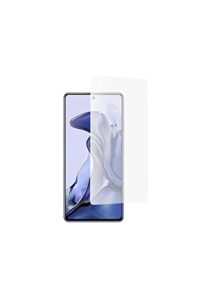 Dalip Baby Προστατευτικό οθόνης συμβατό με Xiaomi 11T/11T Pro