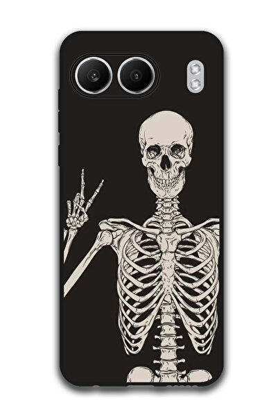 Theodor Protective Case Anti Scratch Shock Proof Bumper Cover For OnePlus Nor...