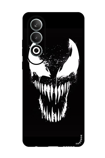 Theodor Protective Case Anti Scratch Shock Proof Bumper Cover For OnePlus Nor...