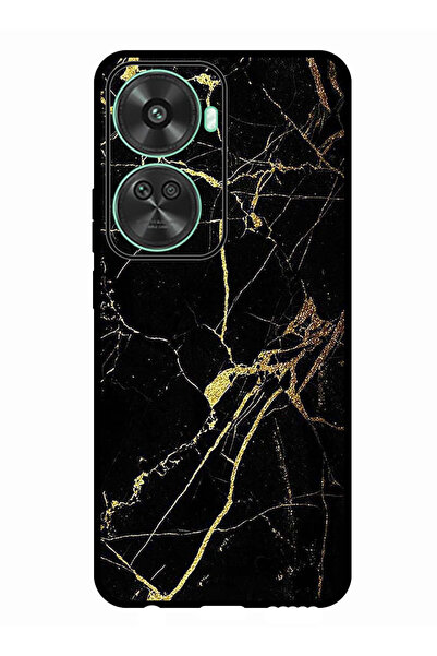 Theodor جراب واقٍ مضاد للخدش والصدمات لهاتف Huawei nova 11 SE بملمس رخامي