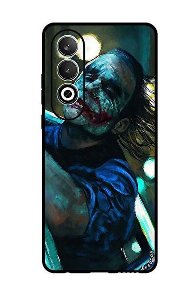 Theodor Protective Case Anti Scratch Shock Proof Bumper Cover For OnePlus Nor...