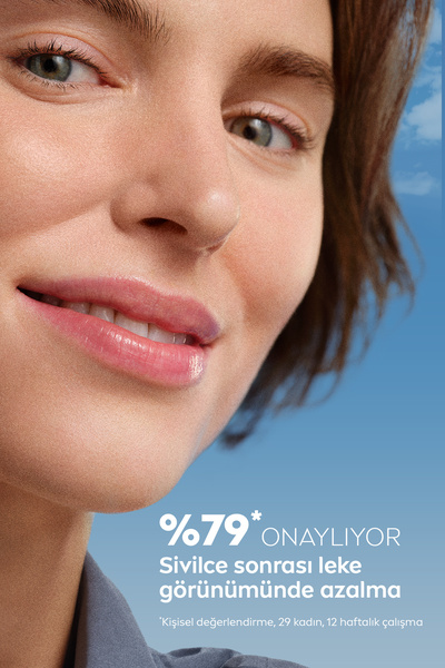 NIVEA Luminous630 Sivilce Lekesi Karşıtı Cilt Serumu 30ml, Salisilik Asit, Hyaluronik Asit, Sivilceli Cilt