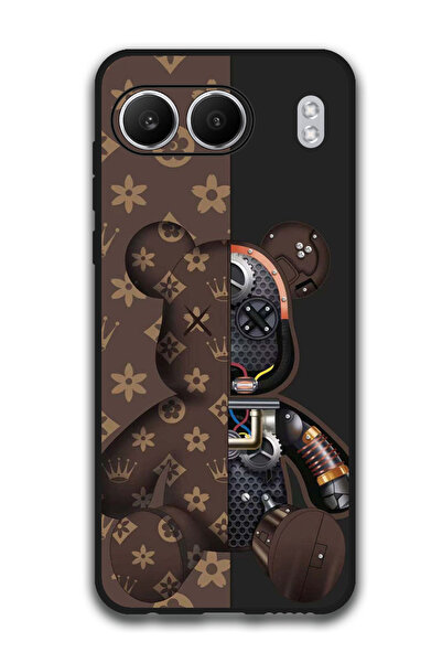 Theodor Protective Case Anti Scratch Shock Proof Bumper Cover For OnePlus Nor...