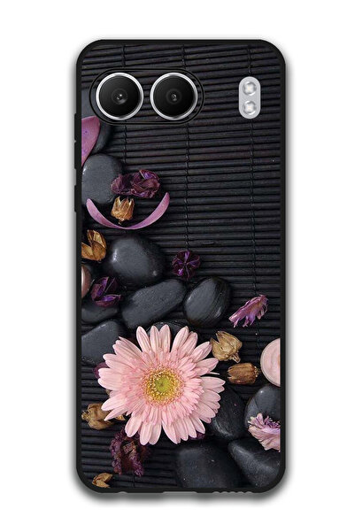 Theodor Protective Case Anti Scratch Shock Proof Bumper Cover For OnePlus Nor...