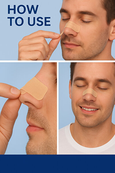 ATLT FRAPAN 10 ADETLİ BURUN BANDI HORMALA BANDI BURUN AÇICI NEFES ALDIRICI