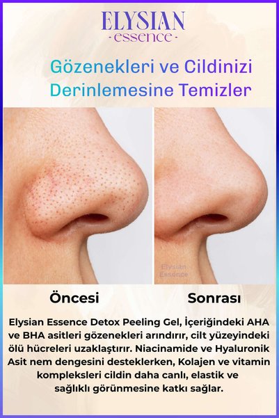 Elysian Essence Detox Peeling Jel 125ml | Ölü Hücre Arındırıcı Temizleme Jeli | Yüz ve Vücut Temizleyici | AHA BHA