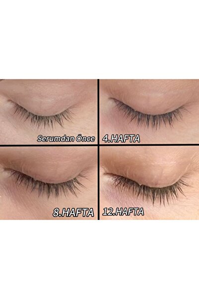 GLOWY Uzatan, Çoğaltan Ve Güçlendiren Kaş Kirpik Bakım Serumu 4.5ml