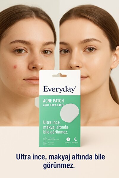 EveryDay Akne Bandı 36 Adet / Bandı - Pimple Patch- Hidrokolloid Bant