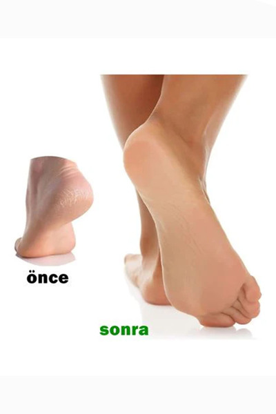 STEEL Topuk Törpüsü Set Ahşap Spatula Sap + 100 Adet Yedek Törpü Ayak Bakımı