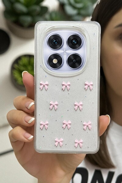 KVK PRİVACY Xiaomi Note 14 Pro 4g Uyumlu Pembe Fiyonk Desenli Şeffaf Yumuşak ...