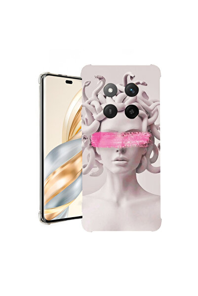 bestcase Αντικραδασμική θήκη πίσω μέρους για Honor Magic7 Lite, Medusa, 19263...