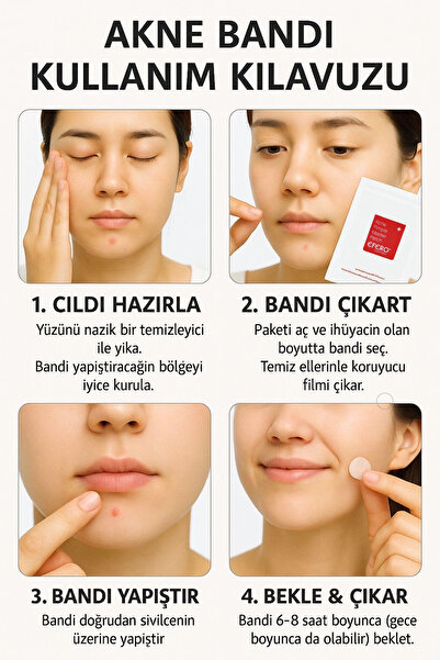 efero 2'li Akne Ve Sivilce Bandı Pimple Patch 72 Patch