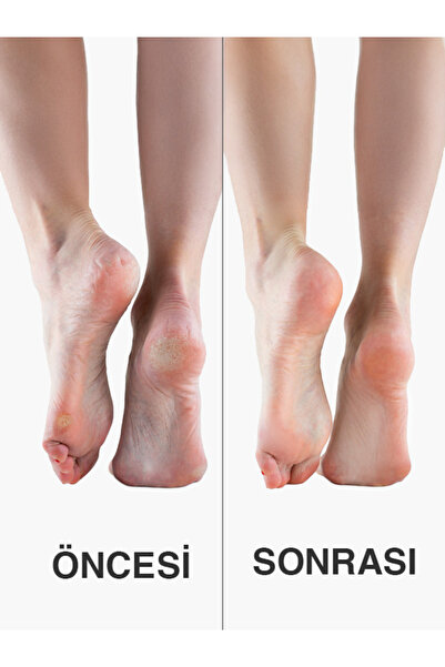 POMEX Topuk Taşı - Ayak Bakımı ve Ölü Deri Temizleyici