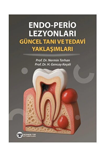Güneş Tıp Kitabevleri Endo - Perio Lezyonları Güncel Tanı ve Tedavi Yaklaşımları
