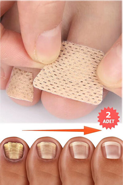 Riddex Mantar Tırnak Yaması – Ayak ve El Tırnakları İçin Güçlü Mantar Tedavis...