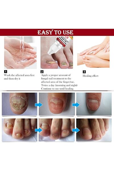 Envisha Soluție pentru repararea unghiilor, Alhena® Envisha, antifungic, loțiune, formulă, transparentă, 10