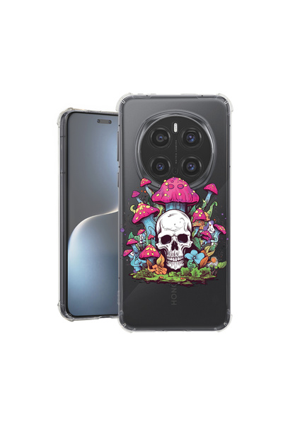 bestcase Carcasă spate antișoc pentru Honor Magic7 Pro, Dream Colors - Craniu...