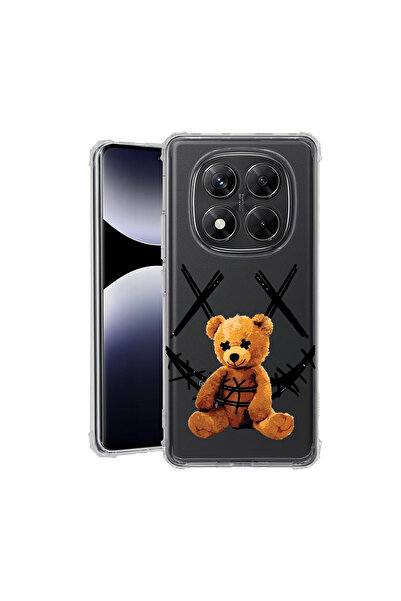 bestcase Carcasă spate antișoc pentru Xiaomi Redmi Note 14 Pro Plus, zâmbet de ursuleț de pluș, 1938410 AS 982