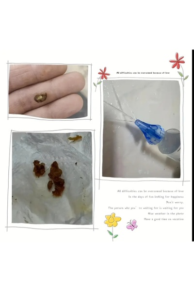 ORGANICYOU YIWU 1 Set Polipropilen Kulak İrrigasyon Sistemi, Evrensel Kulak Y...