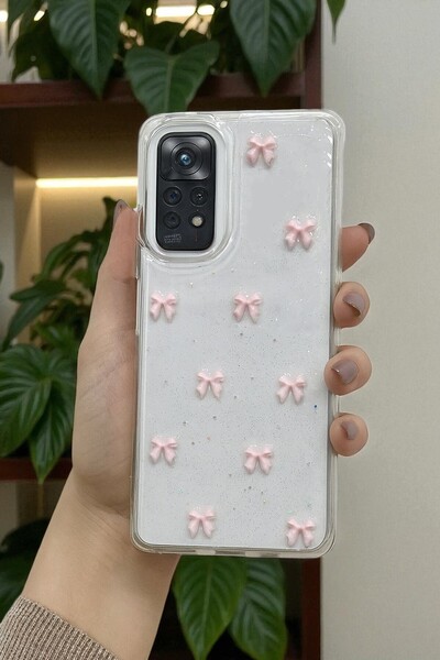 KVK PRİVACY Xiaomi Note 11 Pro 4g / note 12 pro 4g Uyumlu Pembe Fiyonk Desenl...