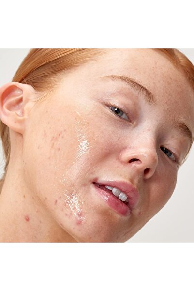 THE INKEY LIST 2% Apple Cider Vinegar Acid Peel a Glow in 10 Minutes to Even Skin Tone and Texture 3