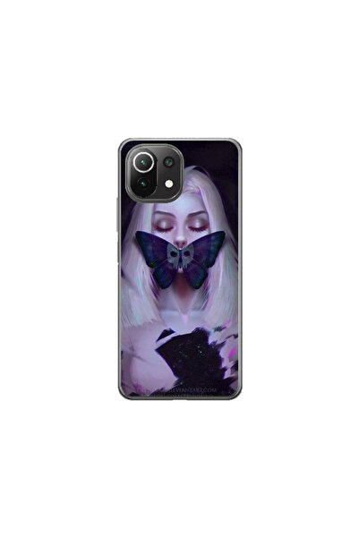 Atlas Husa personalizata tip carcasa Xiaomi Redmi A2, Butterfly Mouth 1, , S1...