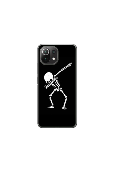 Atlas Husa personalizata tip carcasa Xiaomi Mi 11 Lite, Dab Skeleton, , S1D1M...