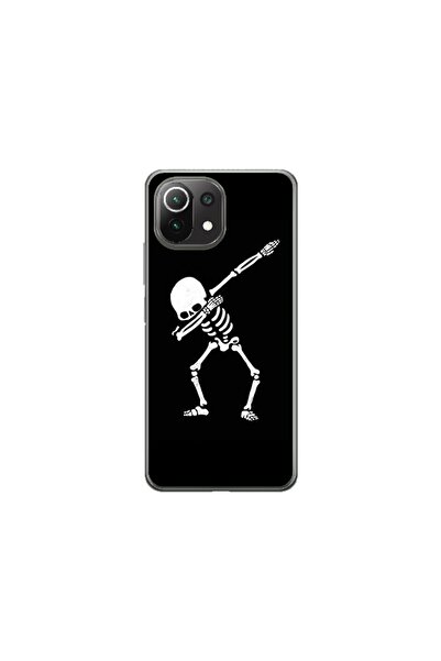 Atlas Husa personalizata tip carcasa Xiaomi Mi 10 Lite 5G, Dab Skeleton, , S1...