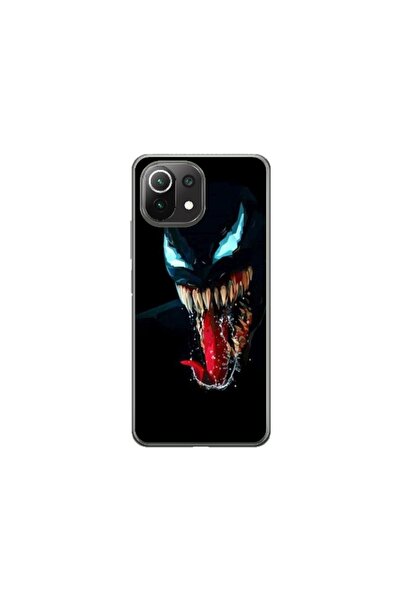 Atlas Husa personalizata tip carcasa Xiaomi Mi 11 Lite, Venom 1, , S1D1M0211