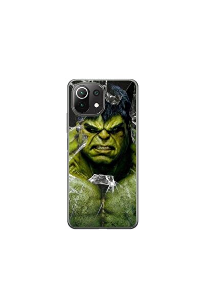 Atlas Προσαρμοσμένος τύπος θήκης Xiaomi Mi 11 Lite, Hulk 2, , S1D1M0100